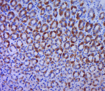 BTG1 Rabbit Polyclonal Antibody