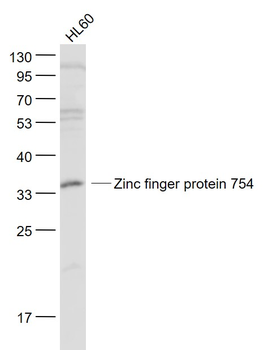 Zinc finger protein 754 Rabbit Polyclonal Antibody