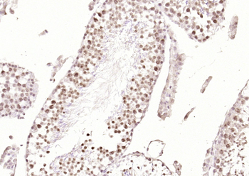 RERE Rabbit Polyclonal Antibody