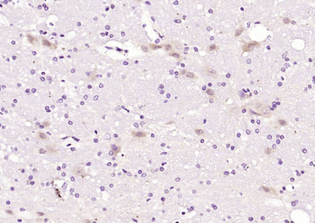 IFRD1 Rabbit Polyclonal Antibody