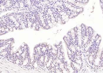 CDCA5 Rabbit Polyclonal Antibody