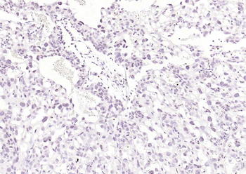CDCA5 Rabbit Polyclonal Antibody