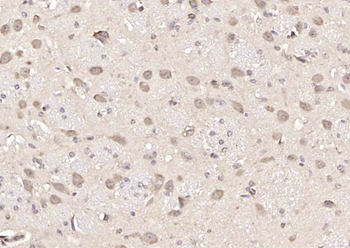 SMC2 Rabbit Polyclonal Antibody