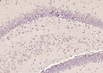 SMC2 Rabbit Polyclonal Antibody