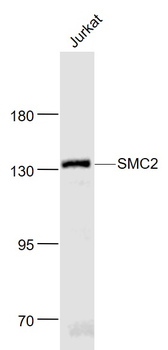 SMC2 Rabbit Polyclonal Antibody