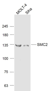 SMC2 Rabbit Polyclonal Antibody