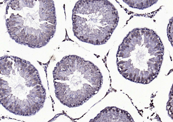 Beta arrestin 2 Rabbit Polyclonal Antibody