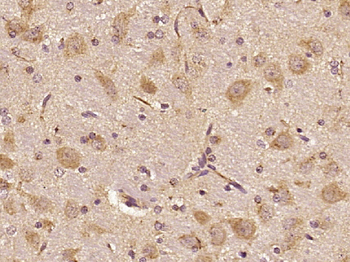 Septin 8 Rabbit Polyclonal Antibody