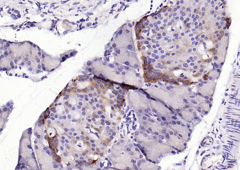 KLHL22 Rabbit Polyclonal Antibody