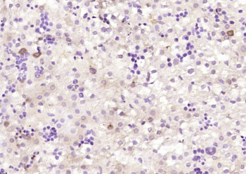 KLHL22 Rabbit Polyclonal Antibody