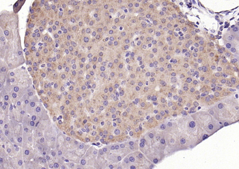 KLHL22 Rabbit Polyclonal Antibody