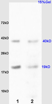 RCL Rabbit Polyclonal Antibody