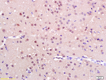 Iroquois homeobox protein 3 Rabbit Polyclonal Antibody
