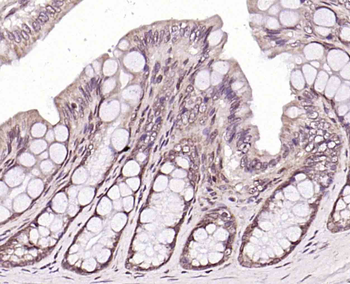 CLK2 Rabbit Polyclonal Antibody