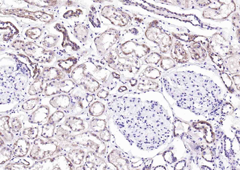 Artemin Rabbit Polyclonal Antibody