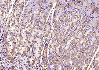 MMP-1 Rabbit Polyclonal Antibody