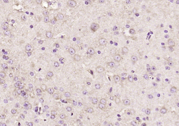 CHMP1A Rabbit Polyclonal Antibody