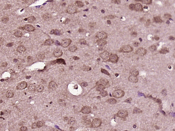 Axin 2 Rabbit Polyclonal Antibody