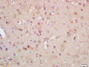 Axin 2 Rabbit Polyclonal Antibody