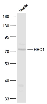 HEC1 Rabbit Polyclonal Antibody