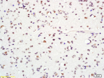 ASCL1 Rabbit Polyclonal Antibody