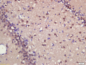 ASCL1 Rabbit Polyclonal Antibody