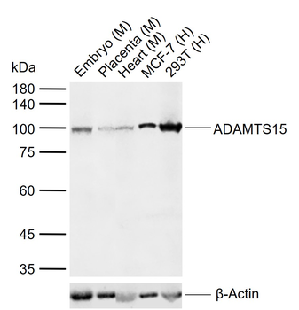 ADAMTS15 Rabbit Polyclonal Antibody