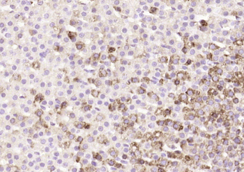 KLK15 Rabbit Polyclonal Antibody