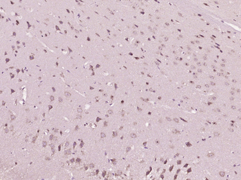 Styk1 Rabbit Polyclonal Antibody