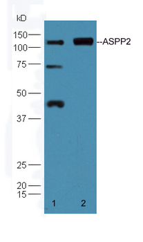ASPP2 Rabbit Polyclonal Antibody