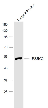 RSRC2 Rabbit Polyclonal Antibody