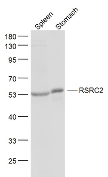 RSRC2 Rabbit Polyclonal Antibody