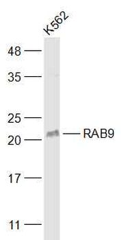 RAB9 Rabbit Polyclonal Antibody
