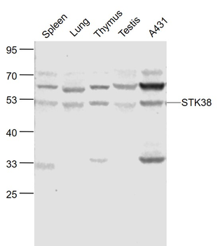 STK38 Rabbit Polyclonal Antibody