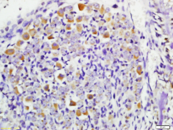 STK38 Rabbit Polyclonal Antibody