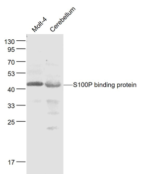 S100P binding protein Rabbit Polyclonal Antibody