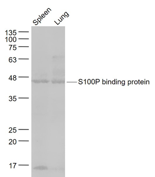 S100P binding protein Rabbit Polyclonal Antibody