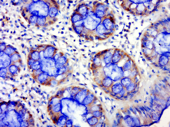 NPHS2 Rabbit Polyclonal Antibody