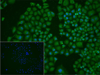 ATF1 Rabbit Polyclonal Antibody