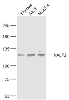 NALP2 Rabbit Polyclonal Antibody