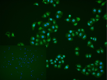 ATF2 Rabbit Polyclonal Antibody