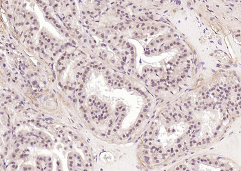 ATF2 Rabbit Polyclonal Antibody