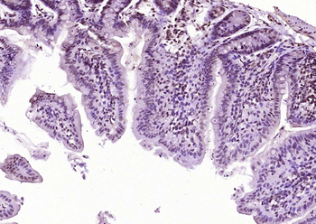 ATF2 Rabbit Polyclonal Antibody