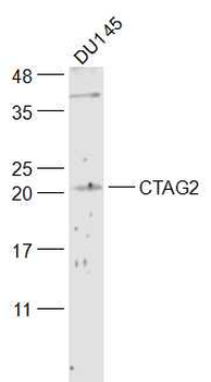 CTAG2 Rabbit Polyclonal Antibody
