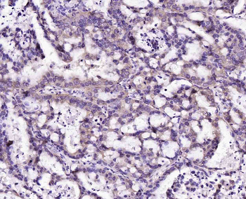 MAGEA11 Rabbit Polyclonal Antibody