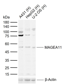 MAGEA11 Rabbit Polyclonal Antibody