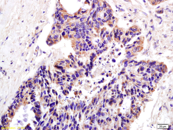 XAGE2 Rabbit Polyclonal Antibody