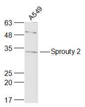 Sprouty 2 Rabbit Polyclonal Antibody
