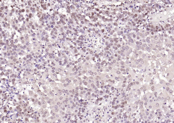TRIB3 Rabbit Polyclonal Antibody