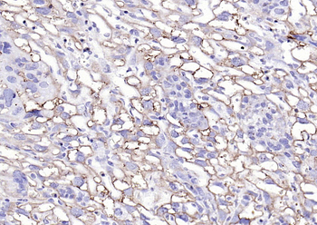 Fibrinogen alpha chain Rabbit Polyclonal Antibody